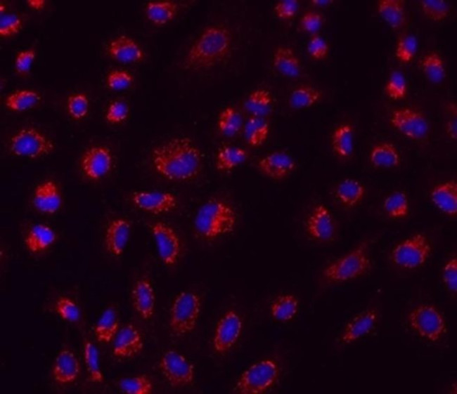 PAR2 Antibody in Immunocytochemistry (ICC/IF)