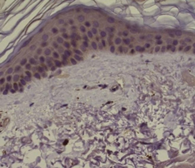 PAR2 Antibody in Immunohistochemistry (Paraffin) (IHC (P))