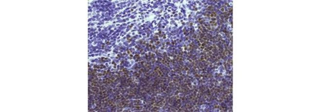 TdT Antibody in Immunohistochemistry (Paraffin) (IHC (P))