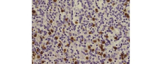 S100A8 Antibody in Immunohistochemistry (Paraffin) (IHC (P))