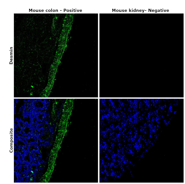 Desmin Antibody in Immunohistochemistry (Paraffin) (IHC (P))