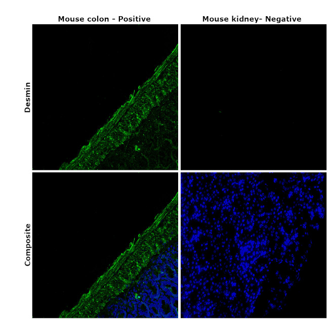 Desmin Antibody in Immunohistochemistry (Paraffin) (IHC (P))