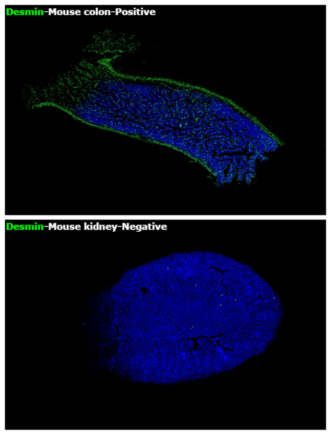 Desmin Antibody in Immunohistochemistry (Paraffin) (IHC (P))