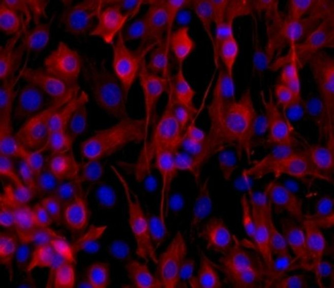 Desmin Antibody in Immunocytochemistry (ICC/IF)