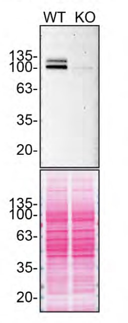 APP (Amyloid Precursor Protein) Antibody