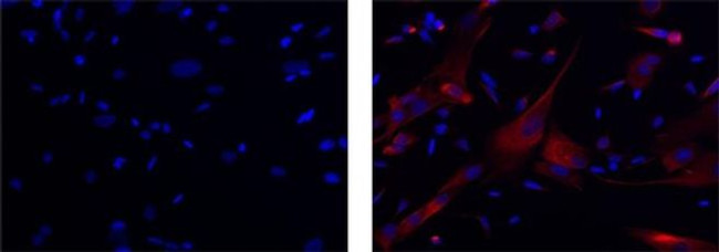 APP (Amyloid Precursor Protein) Antibody in Immunocytochemistry (ICC/IF)