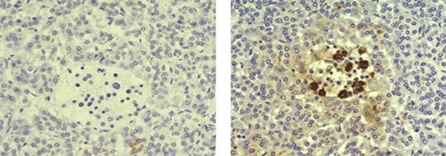 Somatostatin Antibody in Immunohistochemistry (Paraffin) (IHC (P))