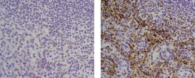 Thrombospondin-1 Antibody in Immunohistochemistry (Paraffin) (IHC (P))