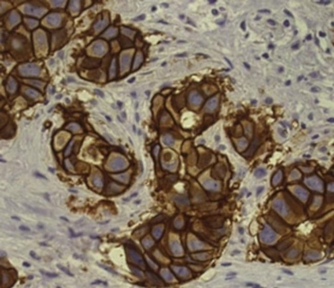 ErbB2 (HER-2) Antibody in Immunohistochemistry (Paraffin) (IHC (P))