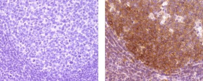 HGAL Antibody in Immunohistochemistry (Paraffin) (IHC (P))