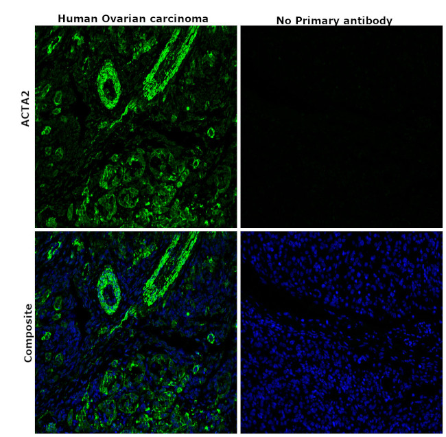 Alpha-Smooth Muscle Actin Antibody in Immunohistochemistry (Paraffin) (IHC (P))