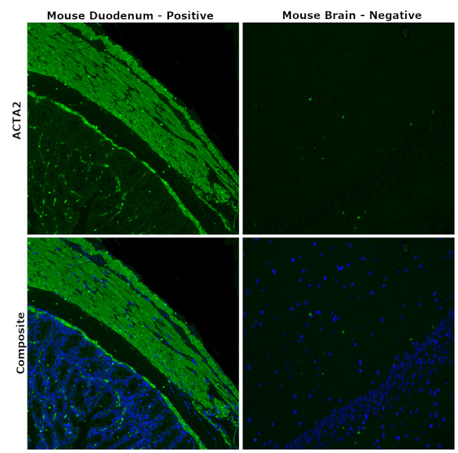 Alpha-Smooth Muscle Actin Antibody in Immunohistochemistry (Paraffin) (IHC (P))