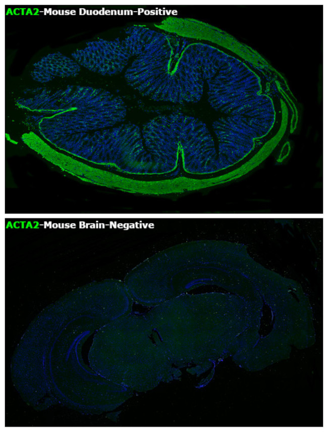 Alpha-Smooth Muscle Actin Antibody