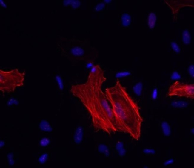 Alpha-Smooth Muscle Actin Antibody in Immunocytochemistry (ICC/IF)