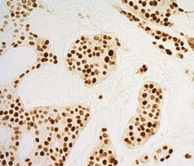 Progesterone Receptor Antibody in Immunohistochemistry (Paraffin) (IHC (P))