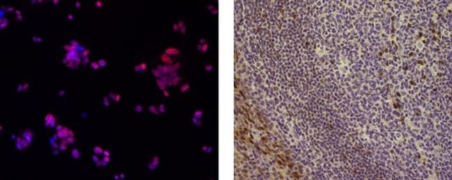 SOX9 Antibody in Immunocytochemistry (ICC/IF)