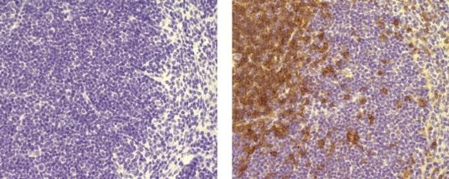 CD4 Antibody in Immunohistochemistry (Paraffin) (IHC (P))