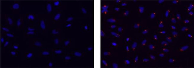 Golgin-97 Antibody in Immunocytochemistry (ICC/IF)