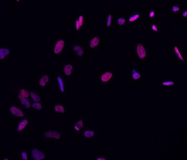 Brachyury Antibody in Immunocytochemistry (ICC/IF)