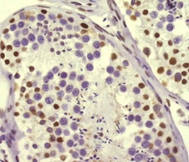 Brachyury Antibody in Immunohistochemistry (Paraffin) (IHC (P))