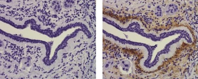 Collagen X Antibody in Immunohistochemistry (Paraffin) (IHC (P))