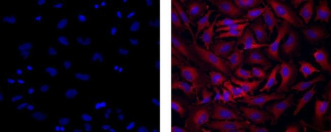 Dynein Antibody in Immunocytochemistry (ICC/IF)