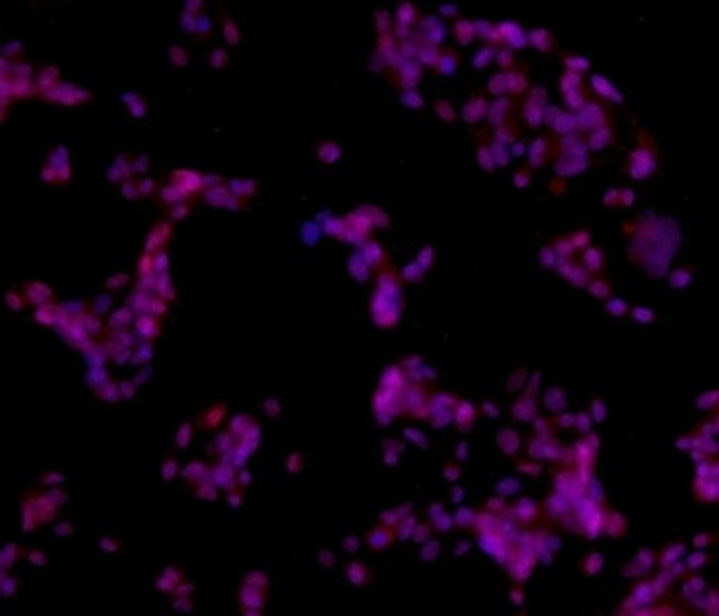 SOX11 Antibody in Immunocytochemistry (ICC/IF)