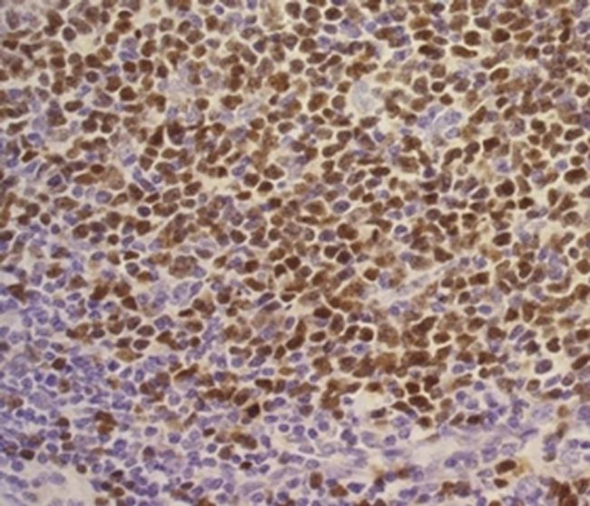 SOX11 Antibody in Immunohistochemistry (Paraffin) (IHC (P))