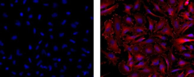 Vinculin Antibody in Immunocytochemistry (ICC/IF)