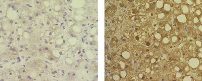 Arginase 1 Antibody in Immunohistochemistry (Paraffin) (IHC (P))