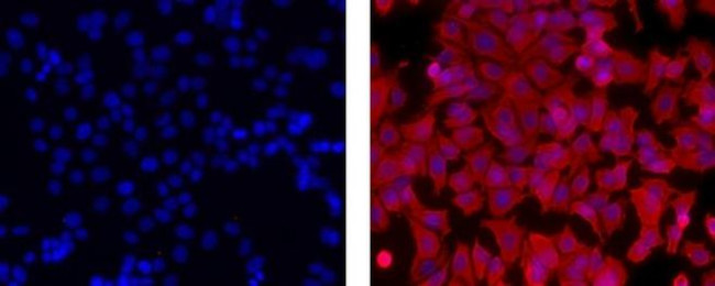 Cytokeratin 18 Antibody in Immunocytochemistry (ICC/IF)