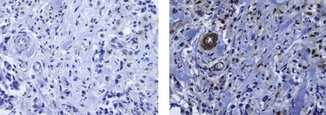 PU.1 Antibody in Immunohistochemistry (Paraffin) (IHC (P))