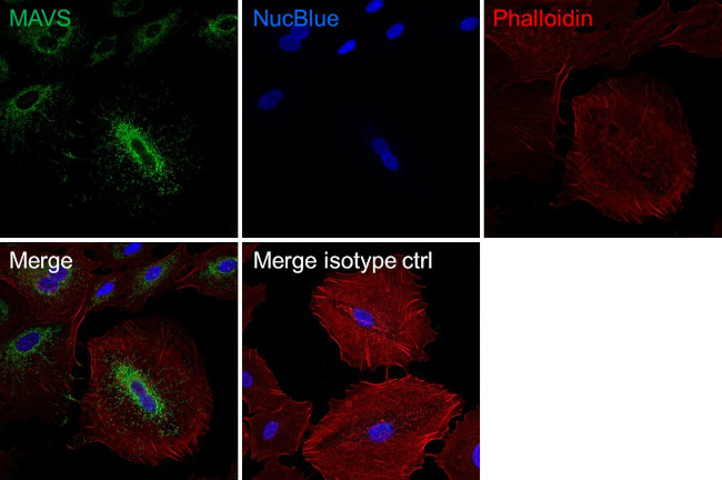 MAVS Antibody in Immunocytochemistry (ICC/IF)