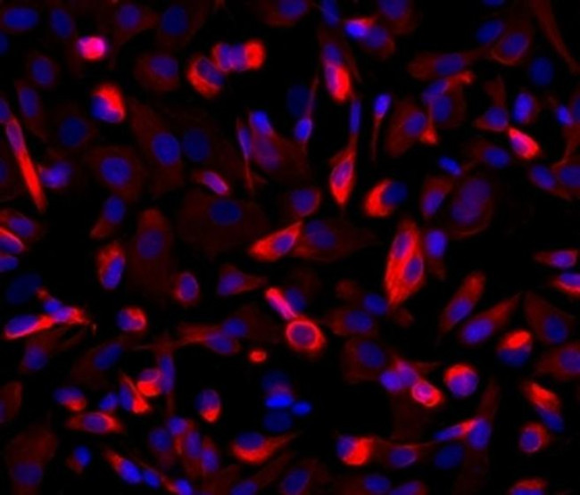 Nestin Antibody in Immunocytochemistry (ICC/IF)