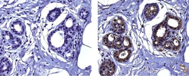 Snail1 Antibody in Immunohistochemistry (Paraffin) (IHC (P))