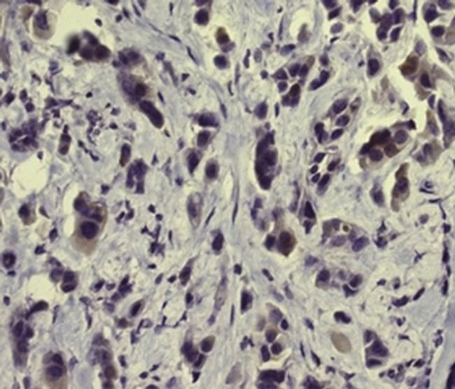 Phospho-NFkB p65 (Ser529) Antibody in Immunohistochemistry (Paraffin) (IHC (P))