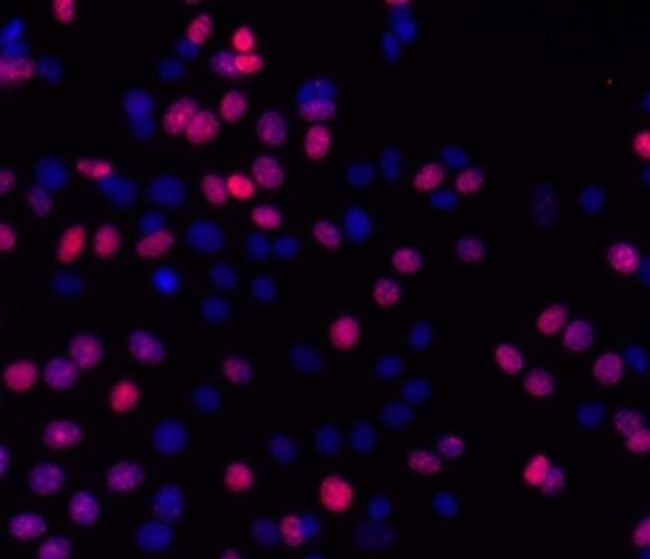 Phospho-Histone H2A.X (Ser139) Antibody in Immunocytochemistry (ICC/IF)