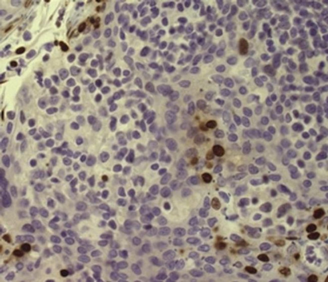 Phospho-Histone H2A.X (Ser139) Antibody in Immunohistochemistry (Paraffin) (IHC (P))