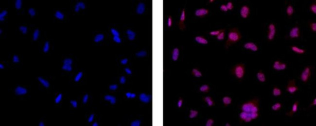 EZH2 Antibody in Immunocytochemistry (ICC/IF)