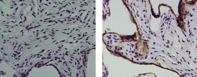 Placental Alkaline Phosphatase Antibody in Immunohistochemistry (Paraffin) (IHC (P))