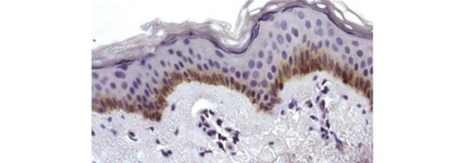 P-cadherin Antibody in Immunohistochemistry (Paraffin) (IHC (P))