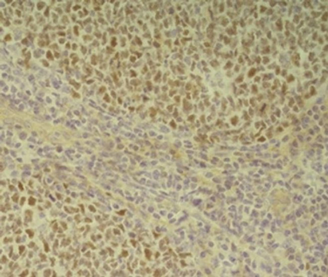 BCL6 Antibody in Immunohistochemistry (Paraffin) (IHC (P))