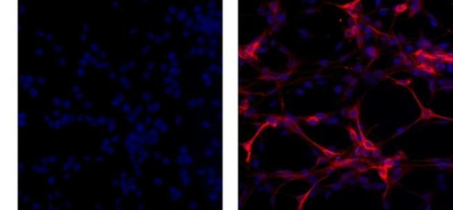 GFAP Antibody in Immunocytochemistry (ICC/IF)