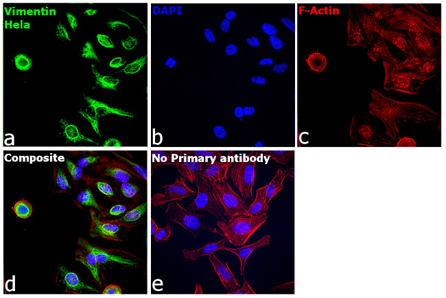 Vimentin Antibody in Immunocytochemistry (ICC/IF)