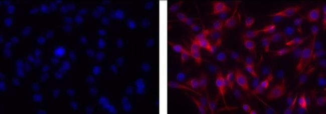 Vimentin Antibody in Immunocytochemistry (ICC/IF)