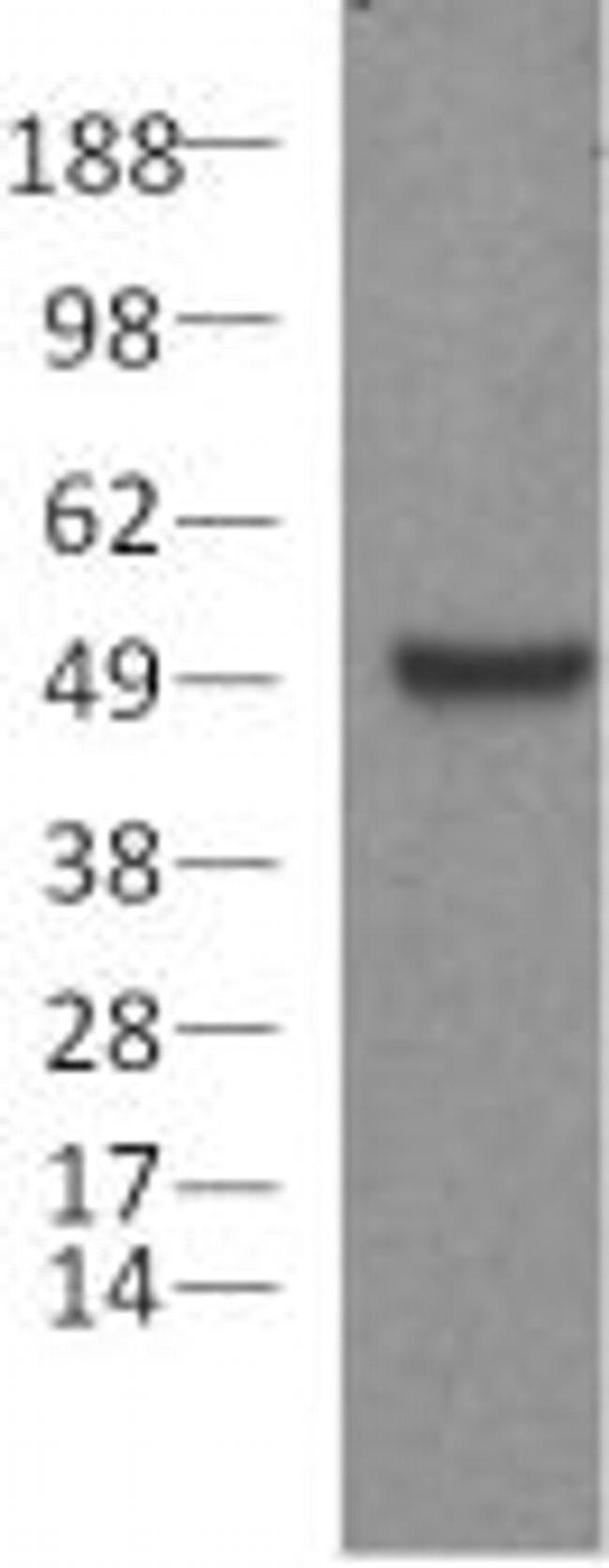 PAX5 Antibody in Western Blot (WB)