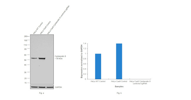 Cytokeratin 8 Antibody