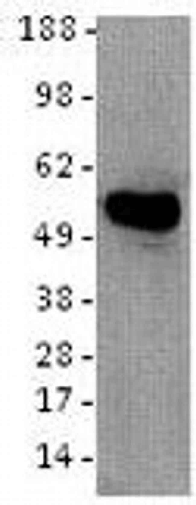 Cytokeratin 8 Antibody in Western Blot (WB)