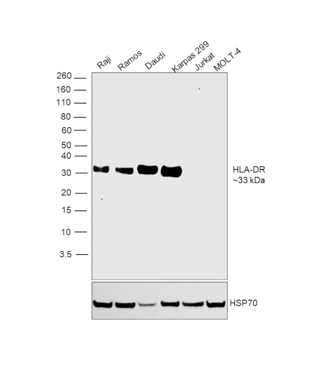 HLA-DR Antibody in Western Blot (WB)