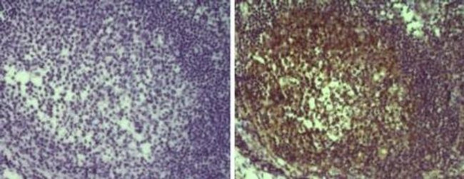 MALT1 Antibody in Immunohistochemistry (Paraffin) (IHC (P))